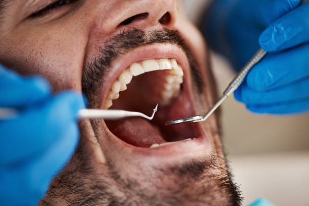Best Broken or Cracked Tooth Emergency Dentist in Plains, TX