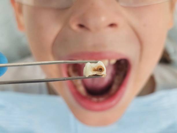 Best Orthodontic Emergency Dentist in Plains, TX